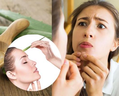 Best Tips On Acne Scar Treatment At Home Best Tips On Acne Scar Treatment At Home